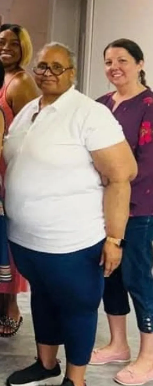 Barbara O. before