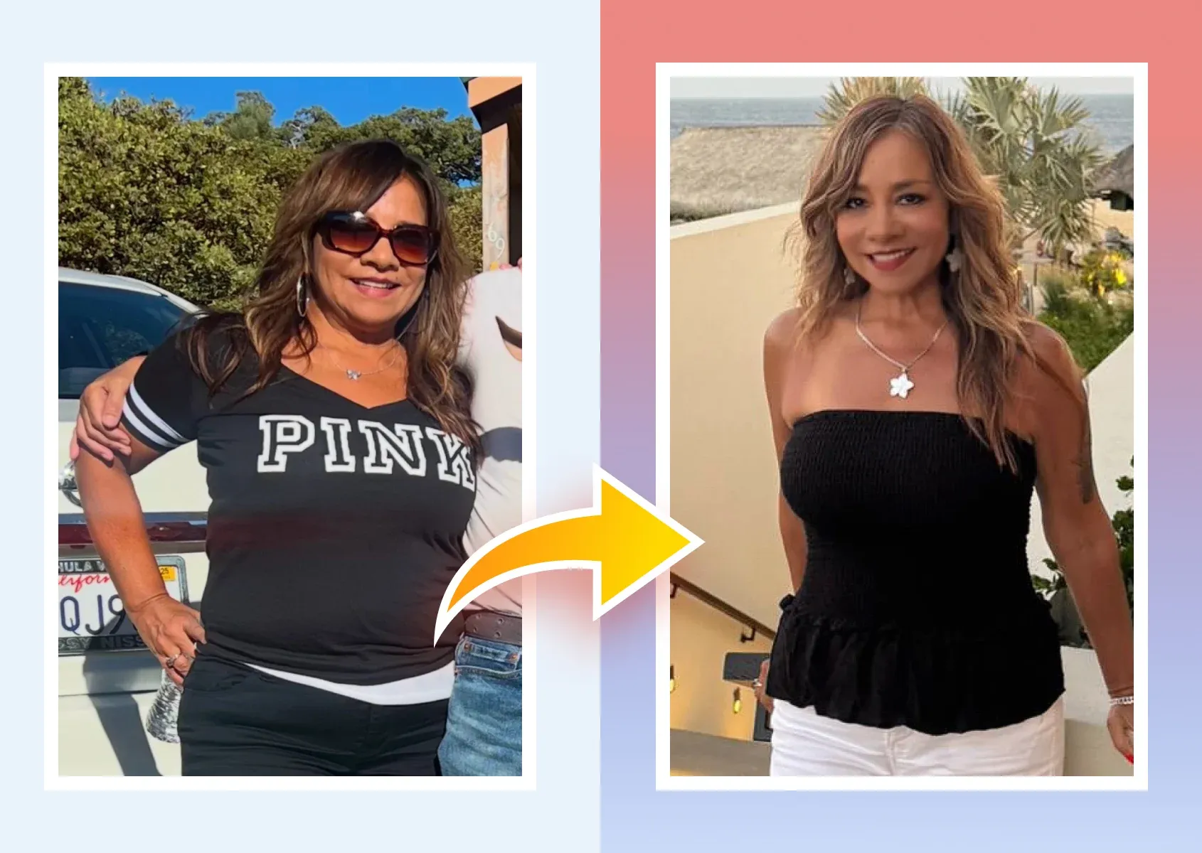 Before and after photos of a real MDWatch patient