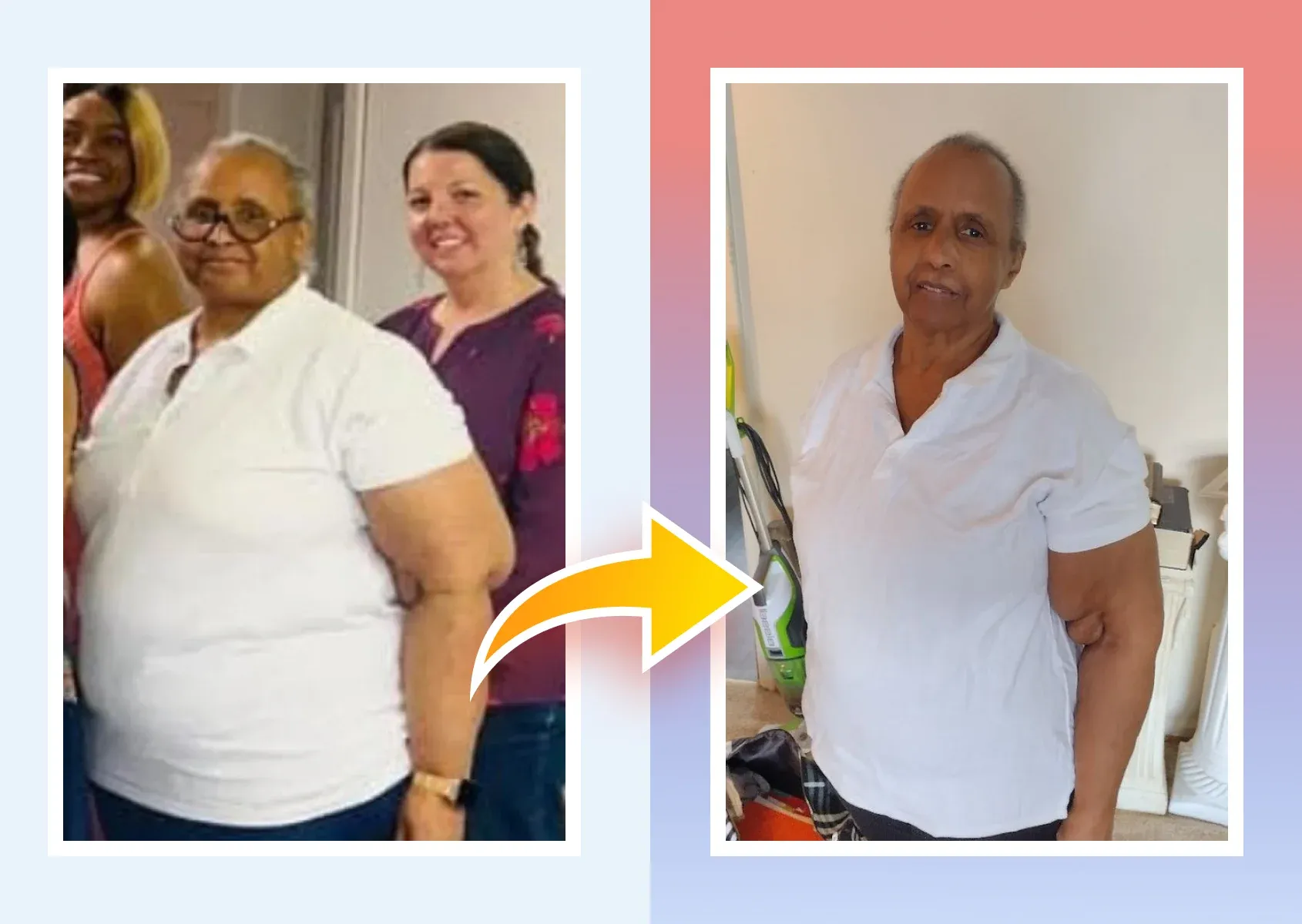 Before and after photos of a real MDWatch patient