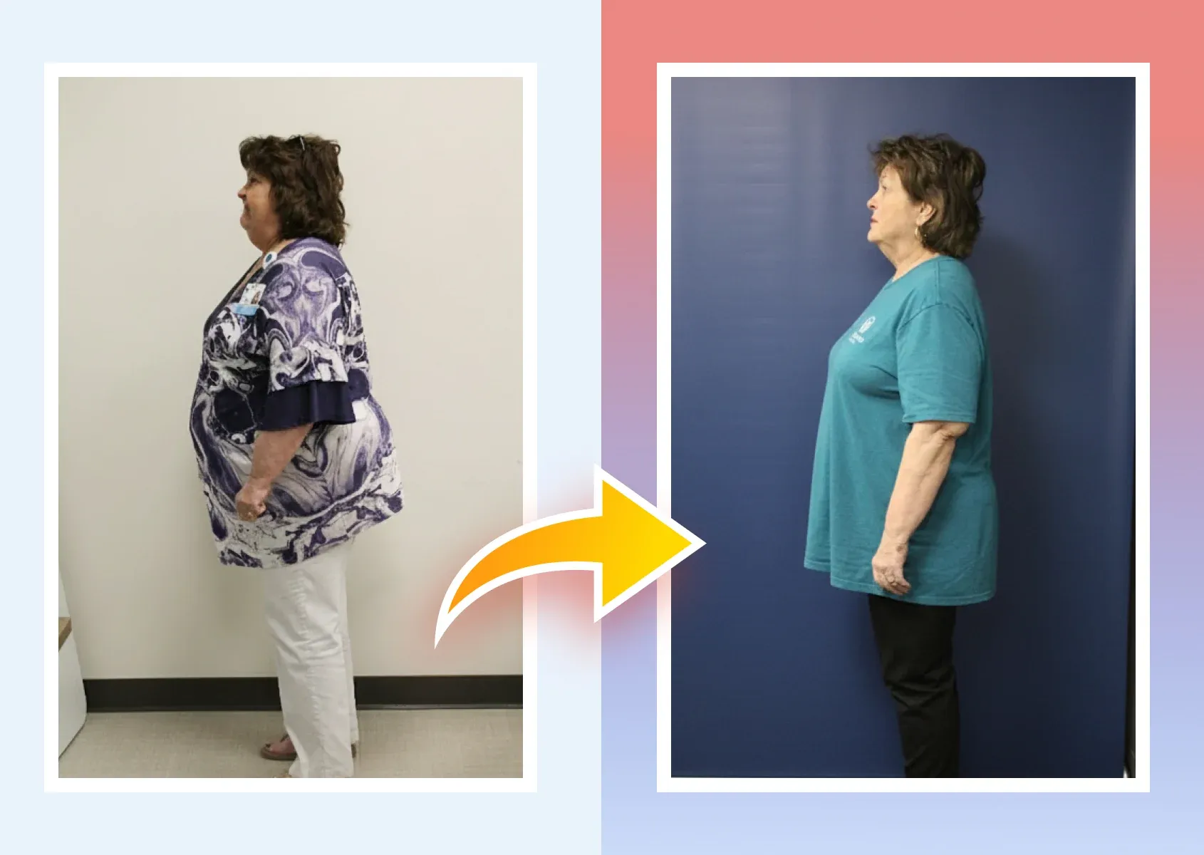 Before and after photos of a real MDWatch patient