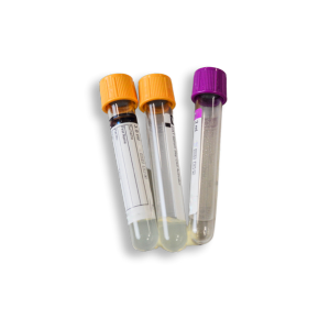 lab tests for seniors