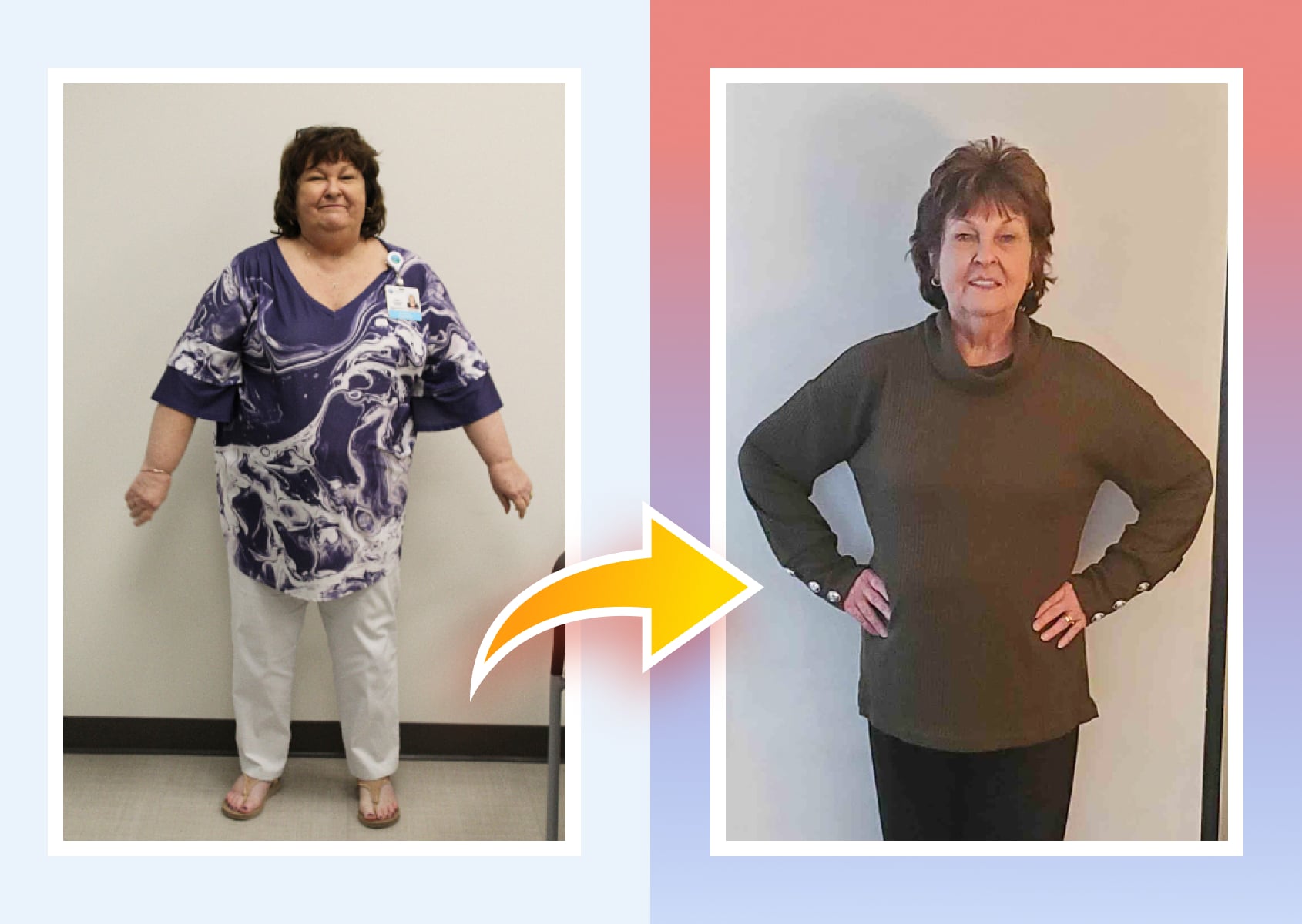shirley w before and after weight loss transformation